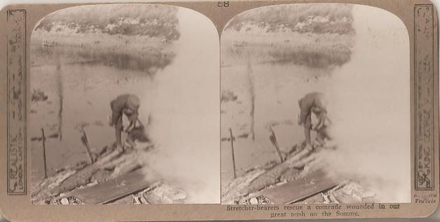 WW1 Stereoview Card (British Stretcher Bearers)